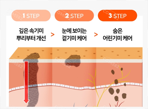 皮肤深层黑色素改善素材图